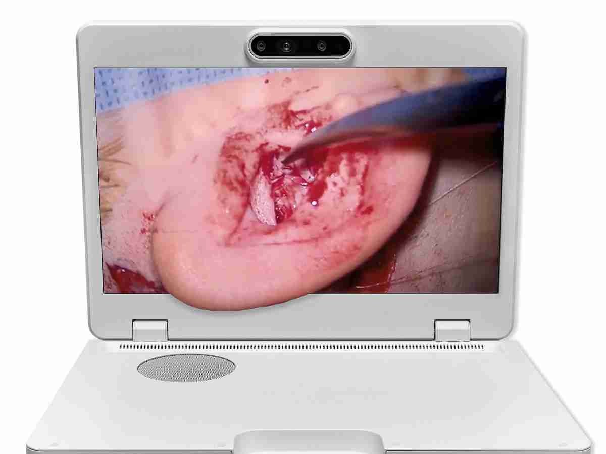 达擎之＂Heads-up 3D显微手术显示系统＂，，整合4K裸眼3D显示及眼球追踪系统，，具备快速追踪人眼移动位置功能，，，减轻医师长时间维持固定姿势的负担，，，，让医师能有更宽广清晰的3D立体视野及更舒适的姿势来执行手术。。